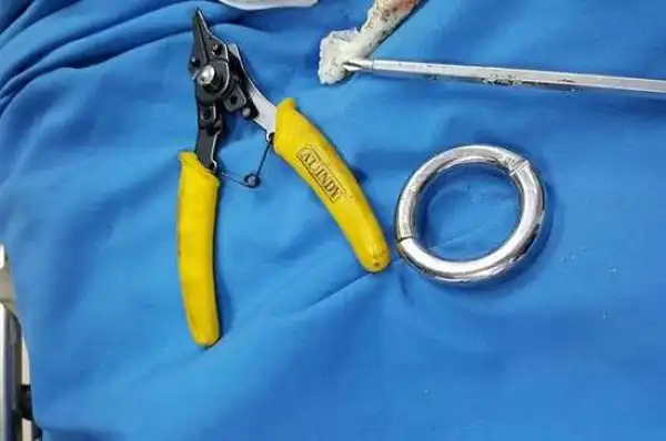 Graphic photos: Doctors use saw and bolt cutters to remove ring that got stuck on mans penis
